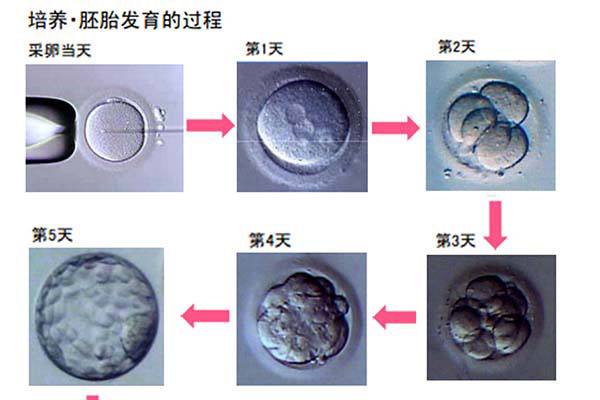 美国试管婴儿