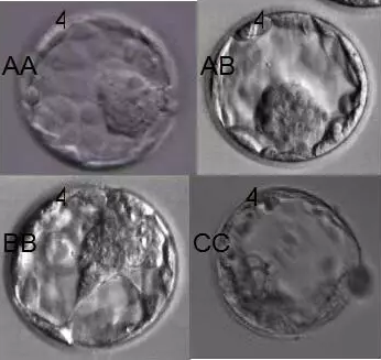 试管婴儿胚胎评级