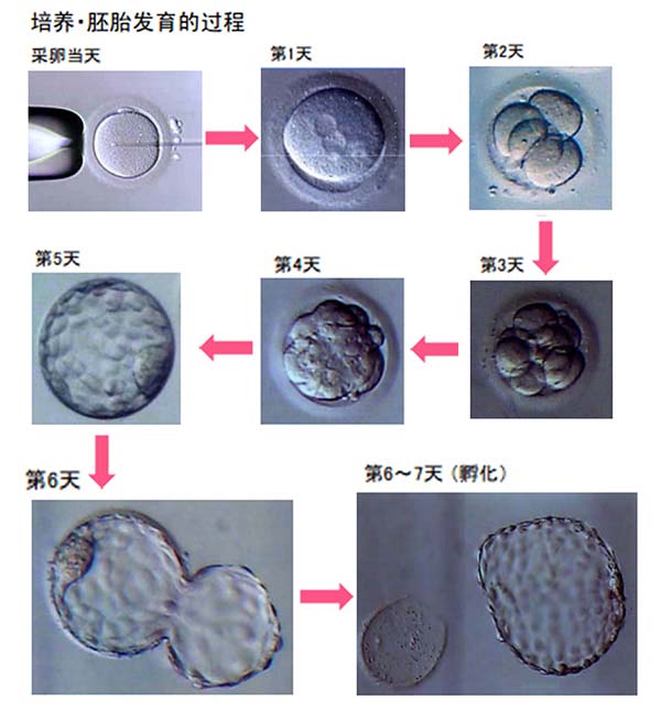 试管婴儿胚胎